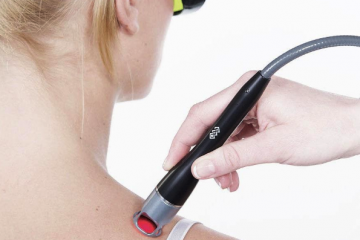 Yüksek Yoğunluklu Lazer